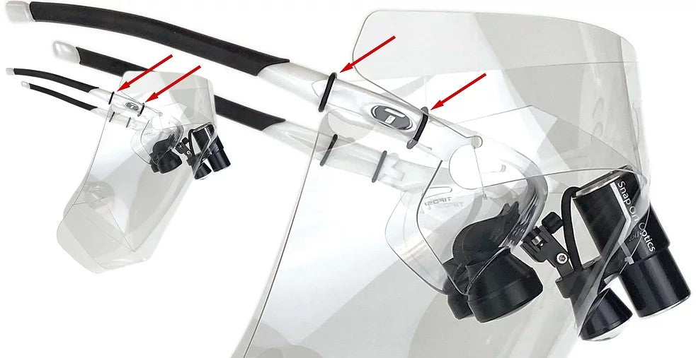 Loupe Mounted Face Shields